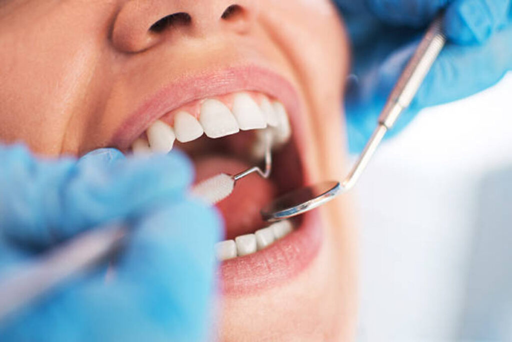 The value of Choosing a Skilled Dentist